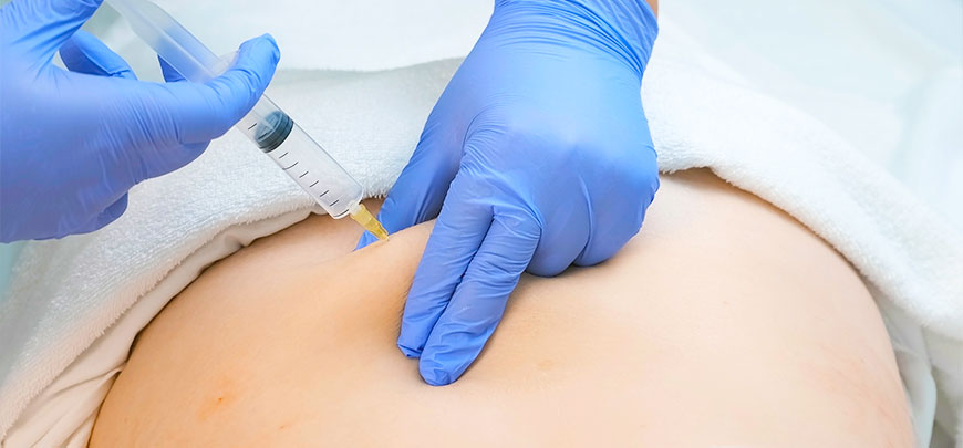 Patient receiving Ozone injection to relieve lower back pain