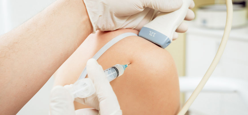 Patient receiving PRP injection to relieve knee pain